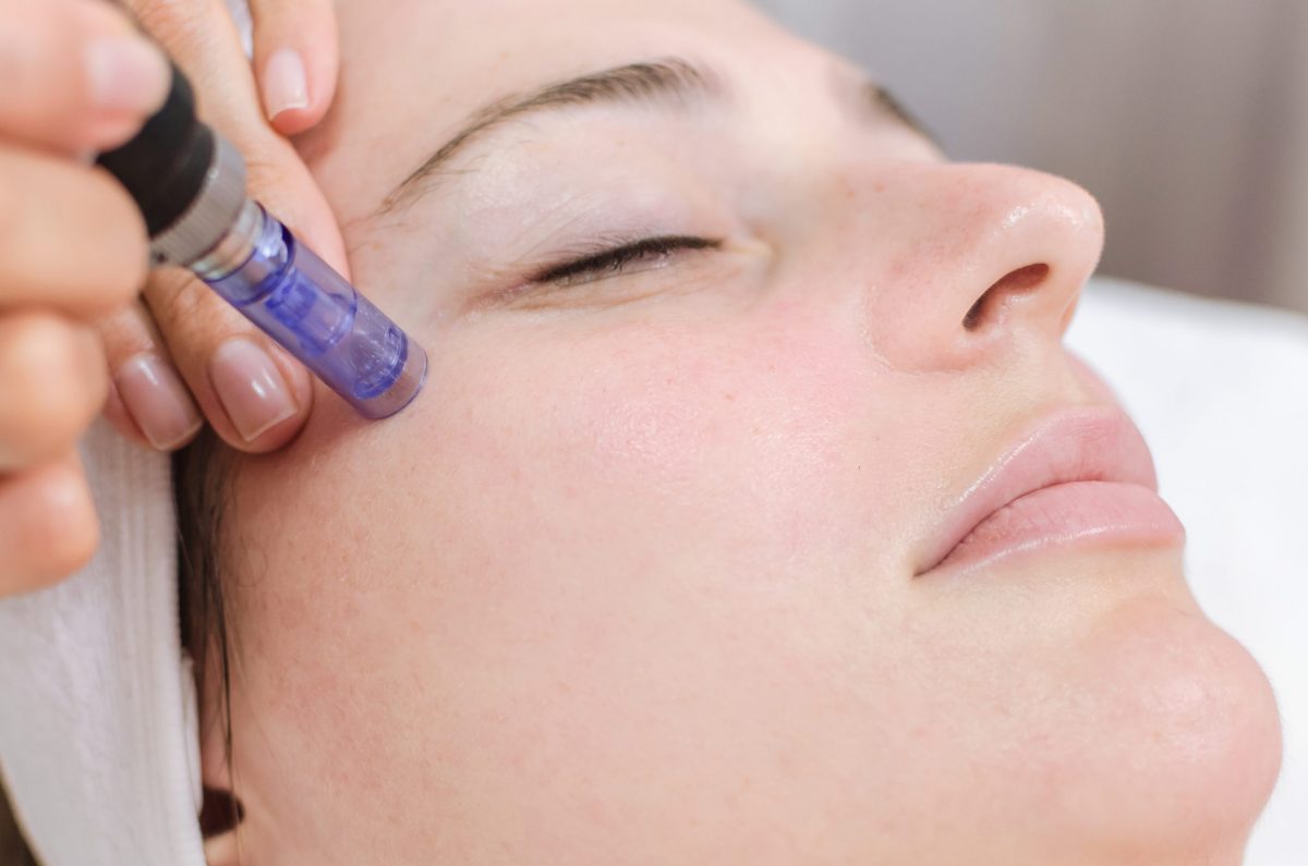 Microneedling  Dover, NH 